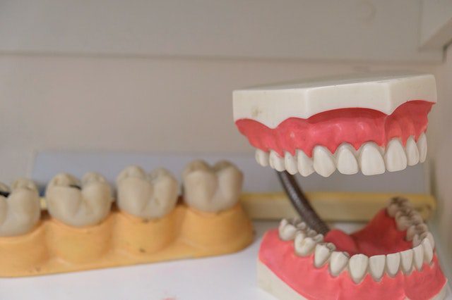 dentures at Smyrna, TN MidTN Dentistry